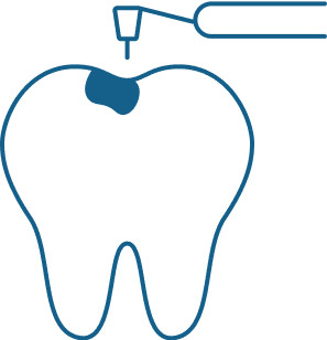 Dental treatment options