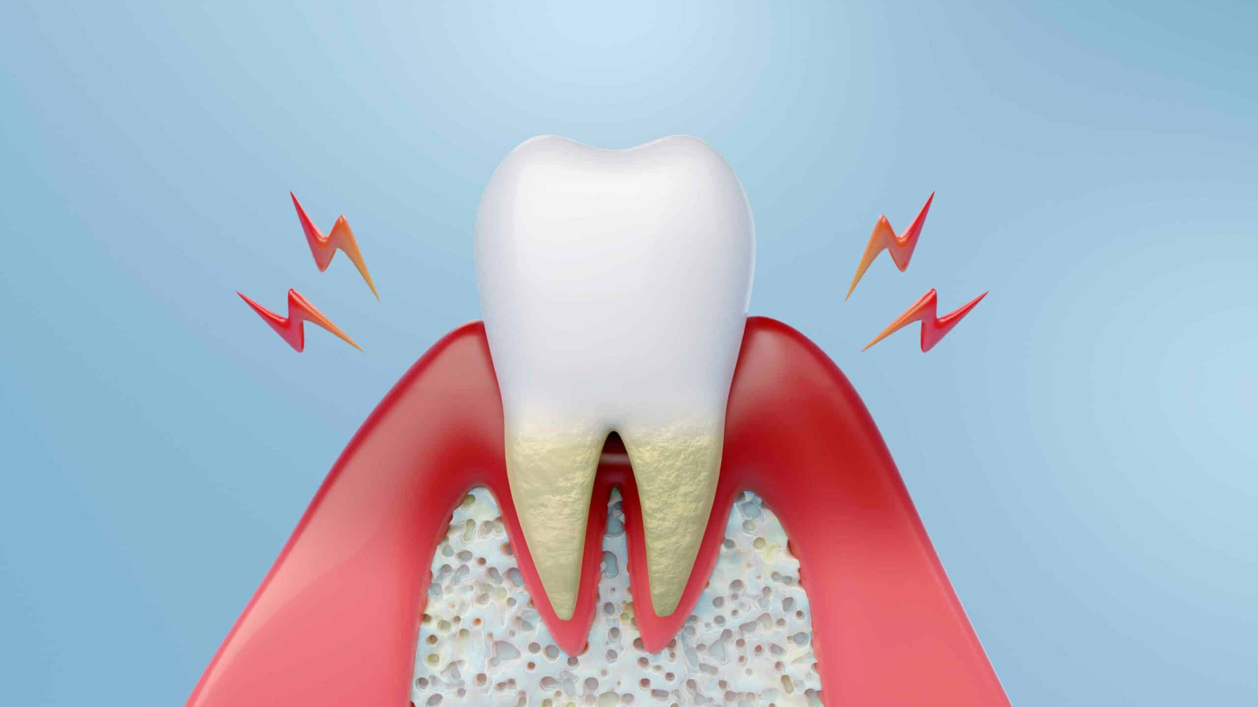 Advanced tools and technology used for gum disease treatment in Toronto