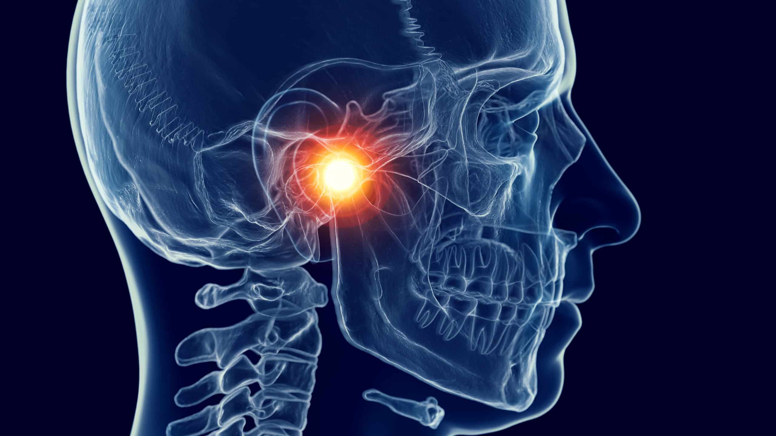TMJ and Jaw Pain – Why Does My Jaw Hurt