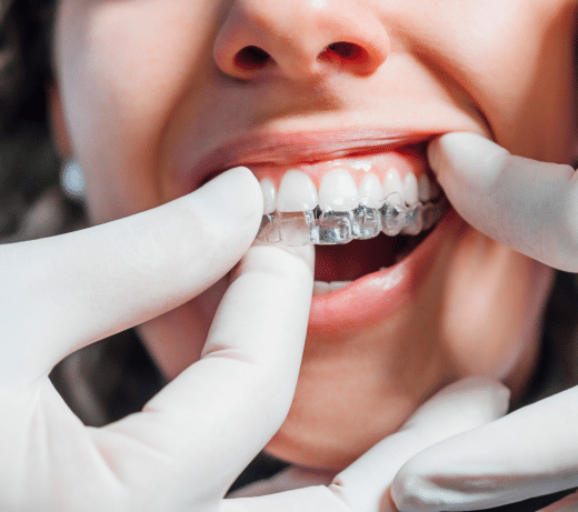 Best Orthodontics In Toronto