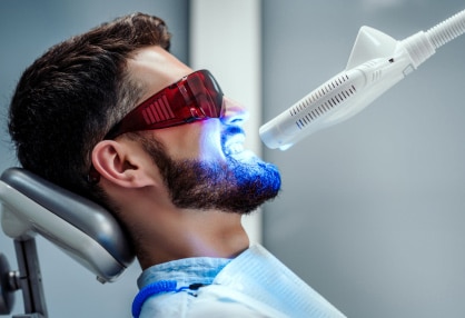 teeth whitening Toronto